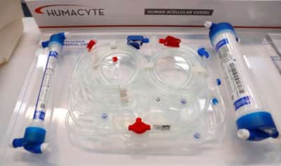 Image for Dialysis firm FMC's earnings miss market view, hit by severe flu season in US