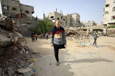 Image for Gaza's war amputees short of prostheses under Israeli restrictions