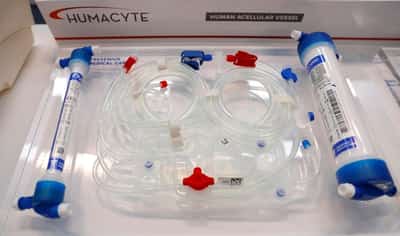 Image for Dialysis firm FMC beats profit estimates in fourth quarter